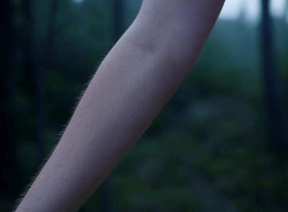 The Science of Goosebumps: Why Your Skin Crawls and What It&nbsp;Means