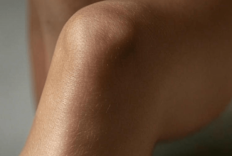 Why Knees Pop: The Odd Noises Your Body Makes, Explained with a&nbsp;Grin